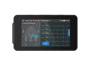 Vergelijking van draagbare Ecg-machines en Holter-bewakingssystemen