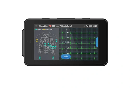 Lepu Medische Handheld PCECG-500 Pocket ECG Machine Draagbare 12-lood Rustende ECG Monitor voor Huiskliniek en Primaire Gezondheidszorg